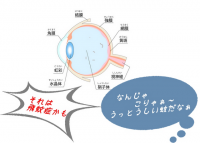 飛蚊症が小さくなった、白内障眼薬が効いたのか？原因と治療法の確認