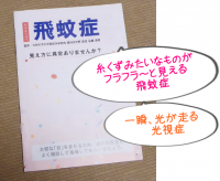 視界異常の飛蚊症と光視症|同時に起きたときは網膜剥離の可能性も